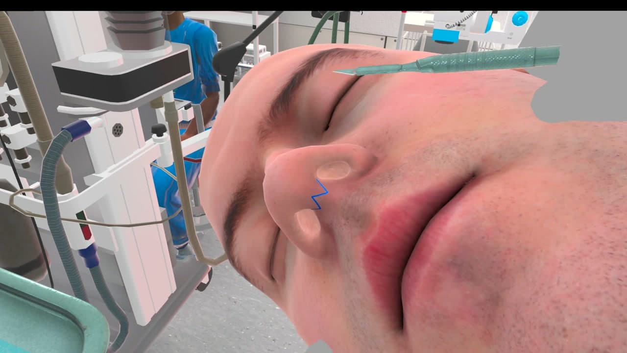 Simulador quirúrgico VR: rinoplastia paso a paso (2)